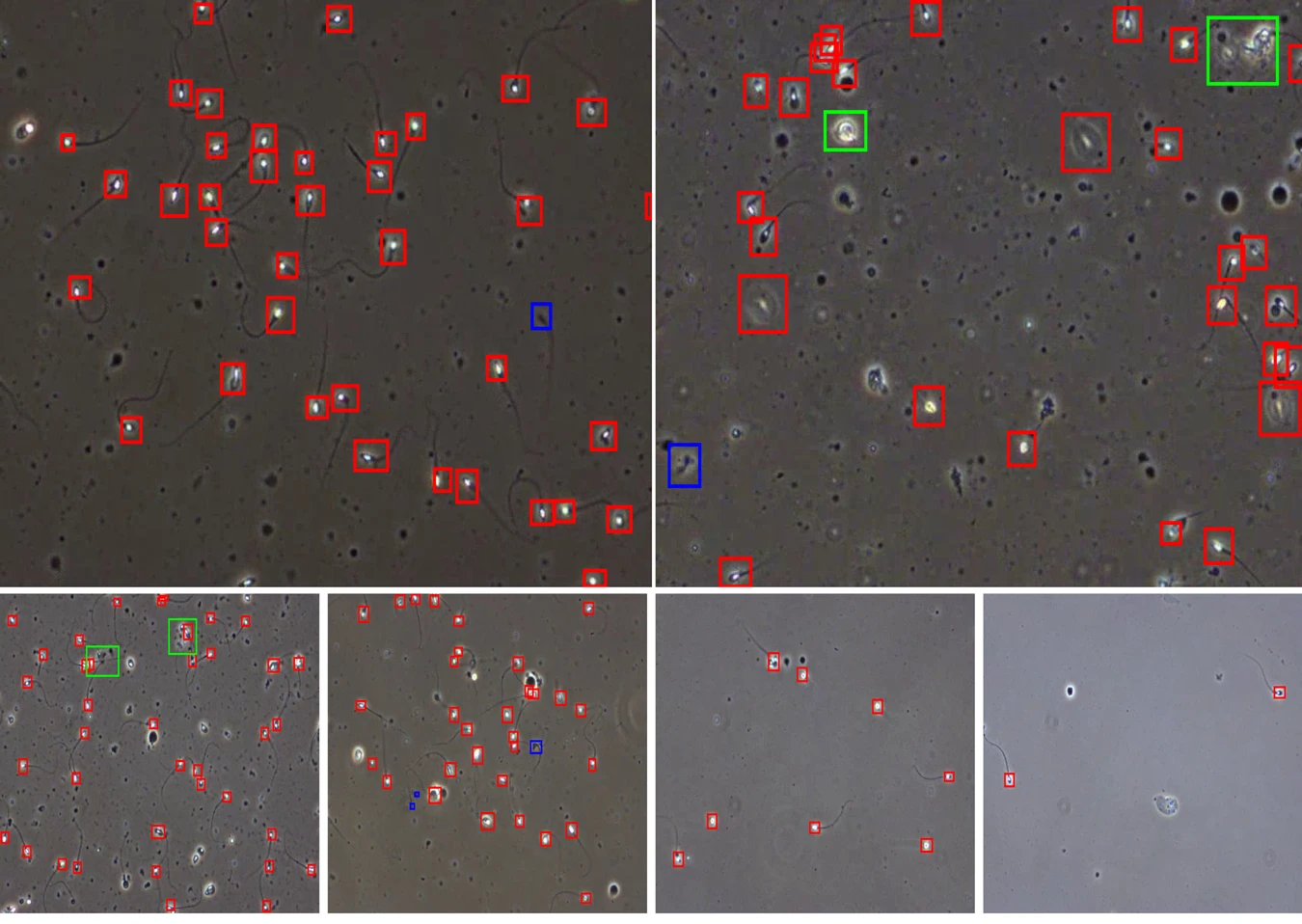 Optimizing Sperm Detection and Tracking in Fluids with Equalize Class Representation Augmentation