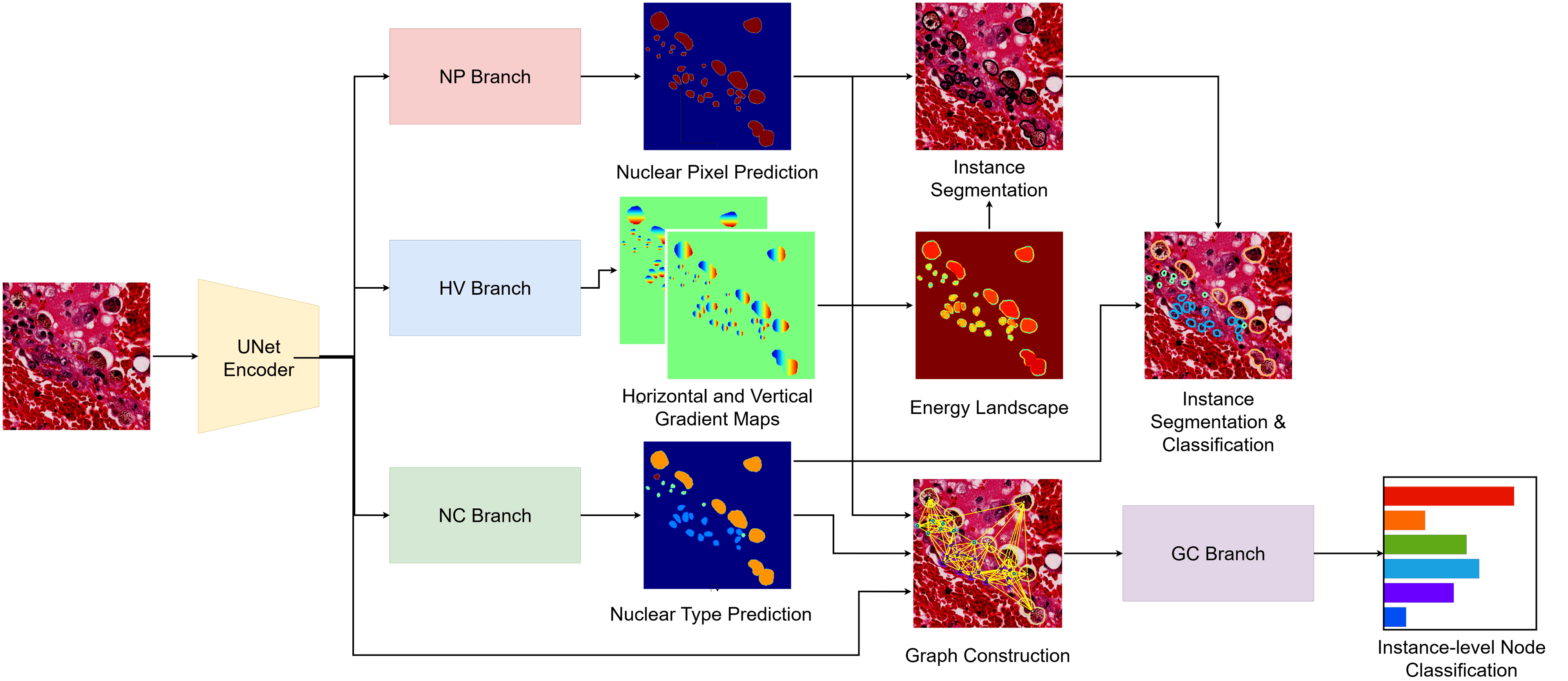 UNet-HoVerGNN: Structured Graph Integration into HoVerNet for Enhanced Nuclei Segmentation and Classification
